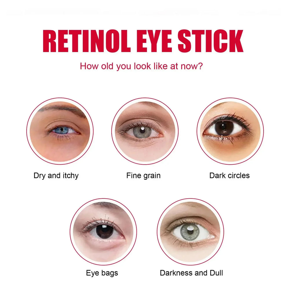face moisturizer - Skincare - Retinol Anti-Aging Eye Cream for Dark Circles