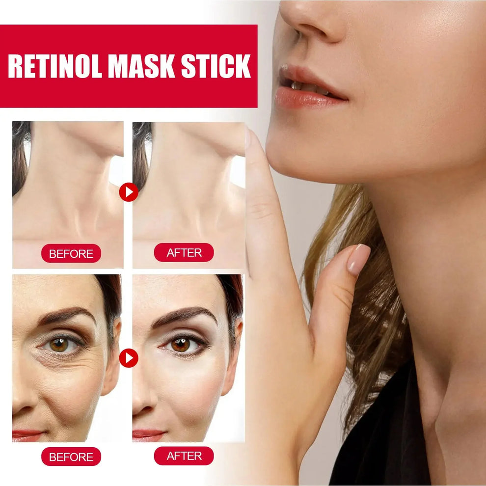 bakuchiol eye cream - Skincare - Retinol Anti-Aging Eye Cream for Dark Circles