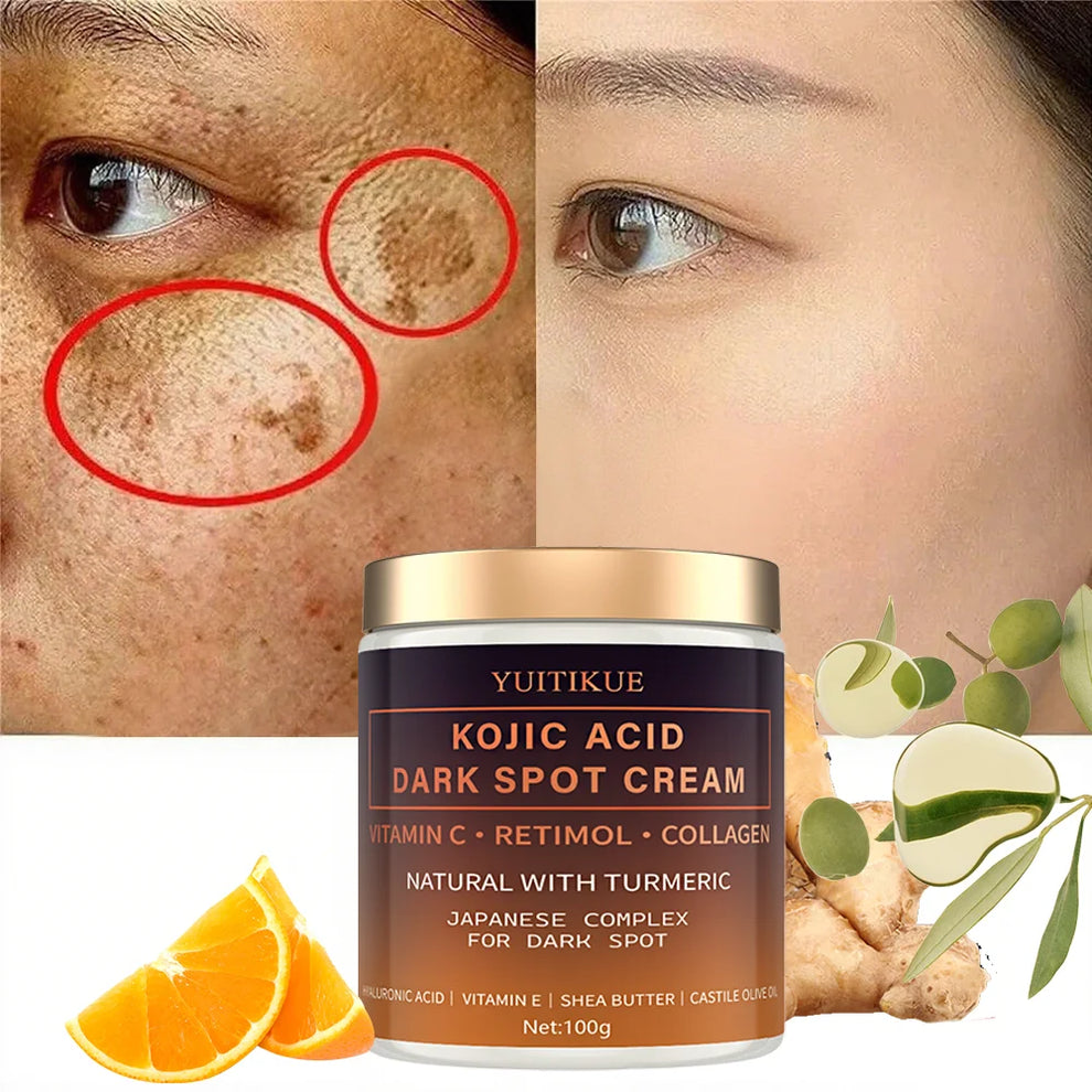alpha arbutin - Skincare - Alpha Arbutin Fading Cream