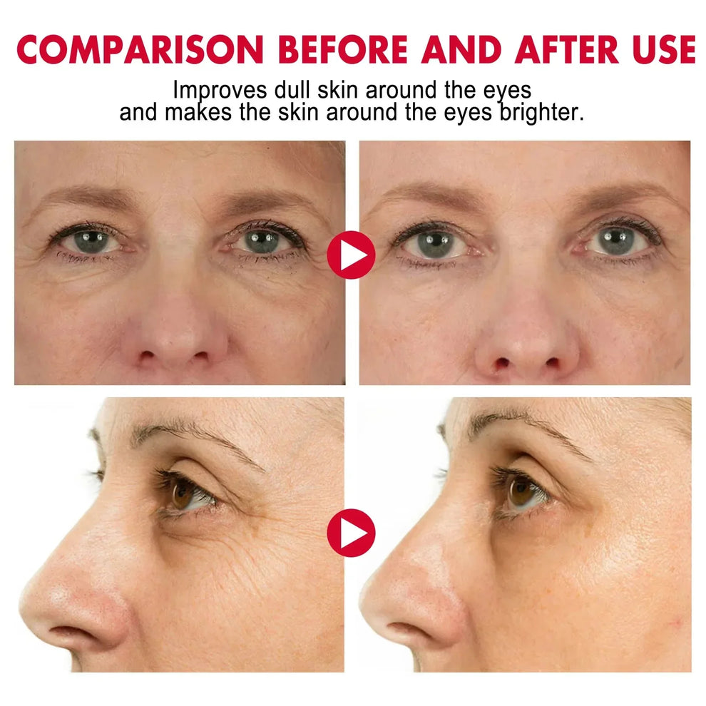dark spot removal cream - Skincare - Retinol Anti-Aging Eye Cream for Dark Circles