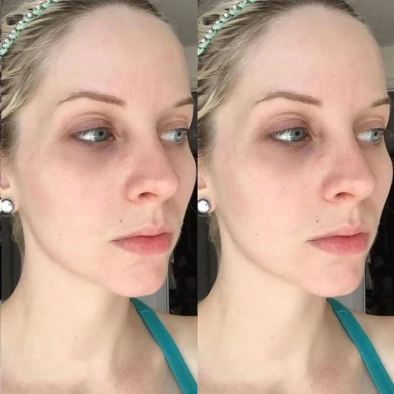 dry skin mask - Skincare - Collagen Peptide Essence Mask Kit