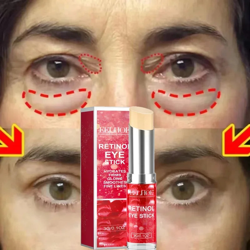 beauty - Skincare - Retinol Anti-Aging Eye Cream for Dark Circles