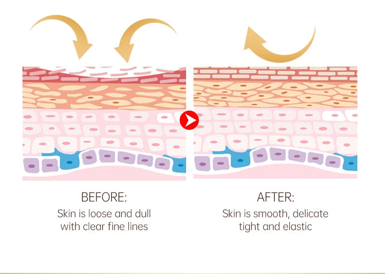 Best eye cream for dark circles and puffiness